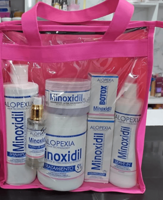 ALOPEXIA MINOXIDIL